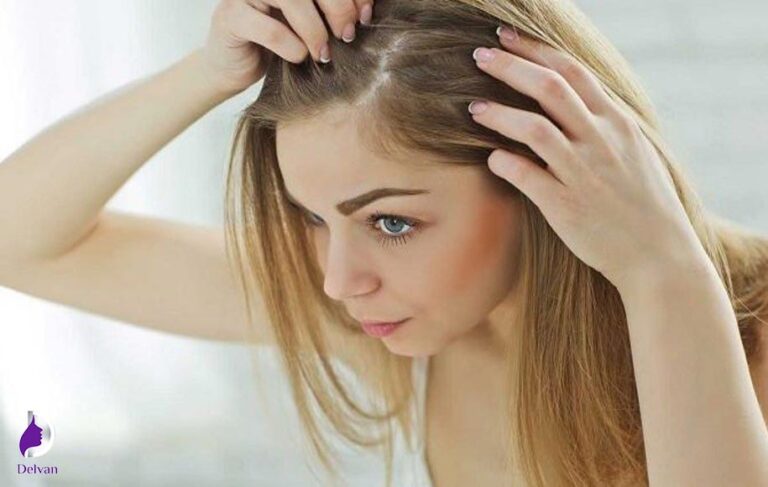 کاشت مو برای زنان و عوارض احتمالی آن