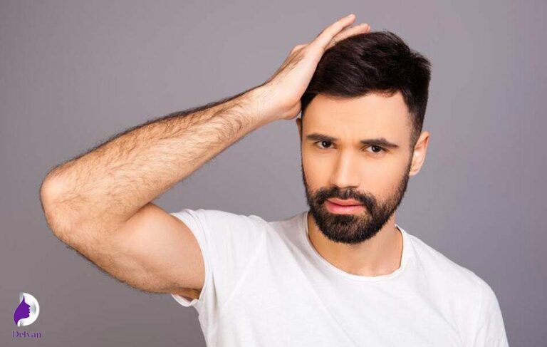 کاشت مو به روش HRT