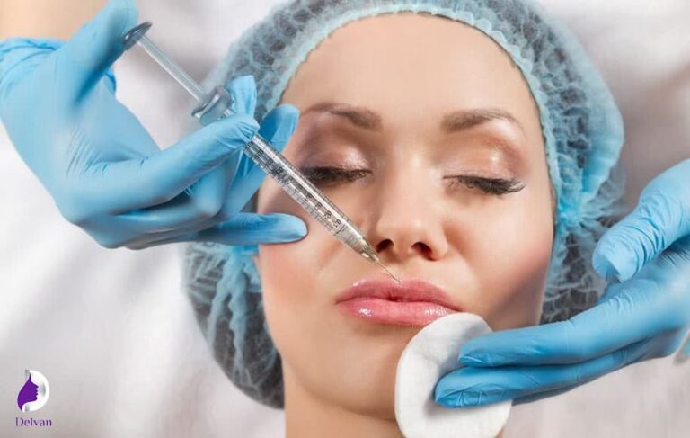 انواع تکنیک‌های تزریق ژل لب