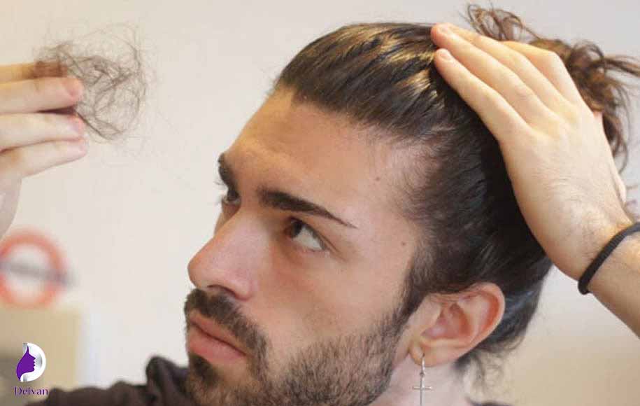 کاشت مو ناموفق چگونه به نظر می‌رسد؟